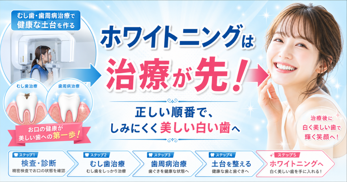 ホワイトニングはむし歯・歯周病治療が先!知っておきたい正しい順番と理由