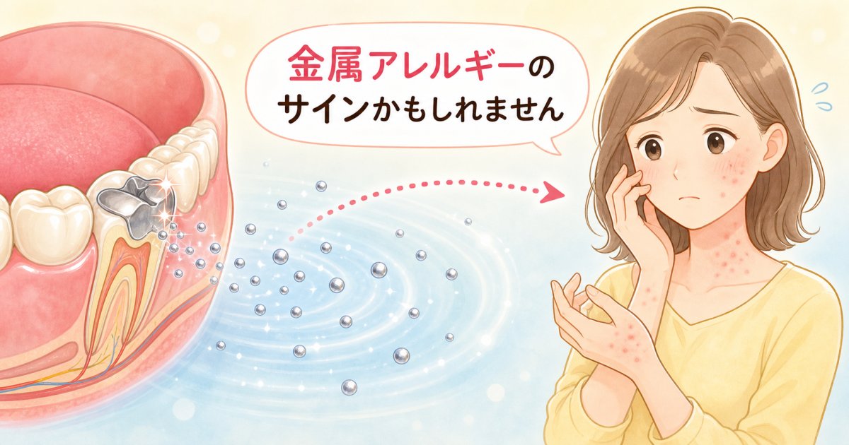 治らない肌荒れは銀歯が理由？金属アレルギーが発生する仕組み
