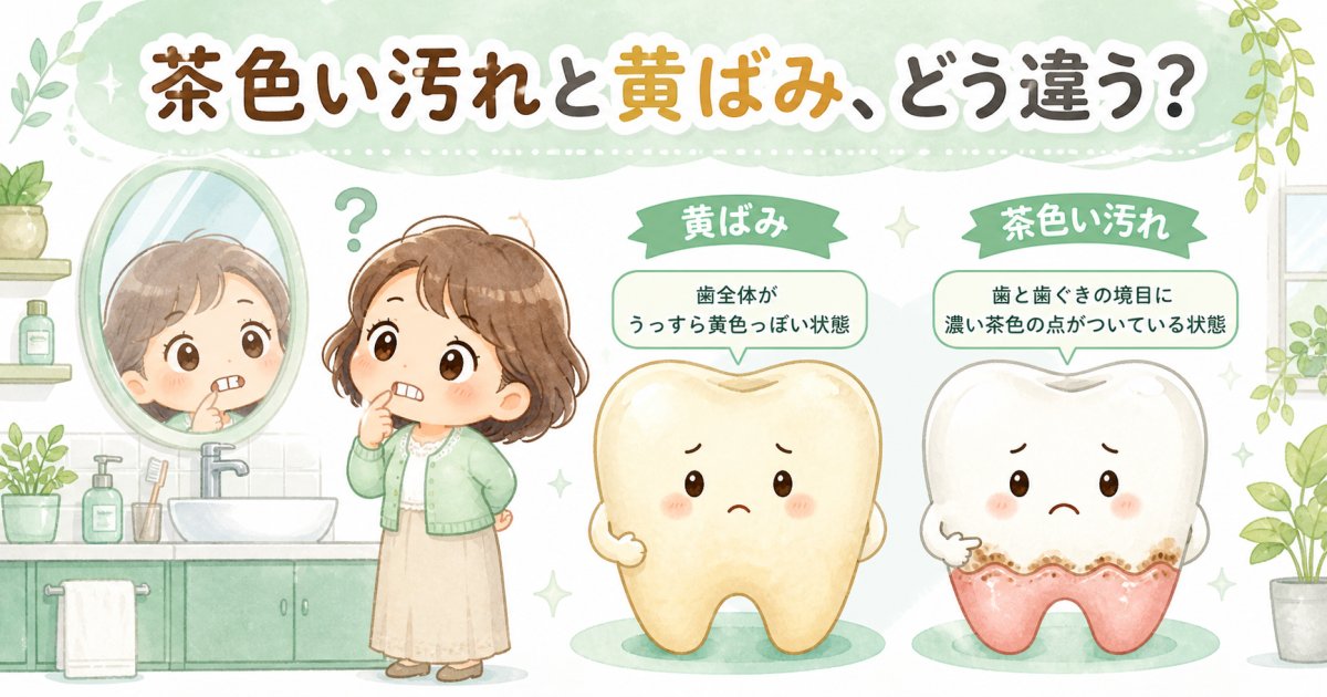 歯の茶色い汚れと黄ばみの違いは？むし歯か見分けるセルフチェック