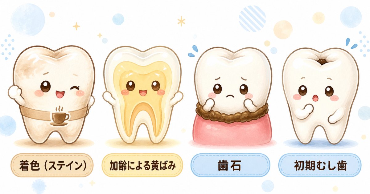 歯の茶色い汚れと全体の黄ばみは何が違う？主な原因を整理