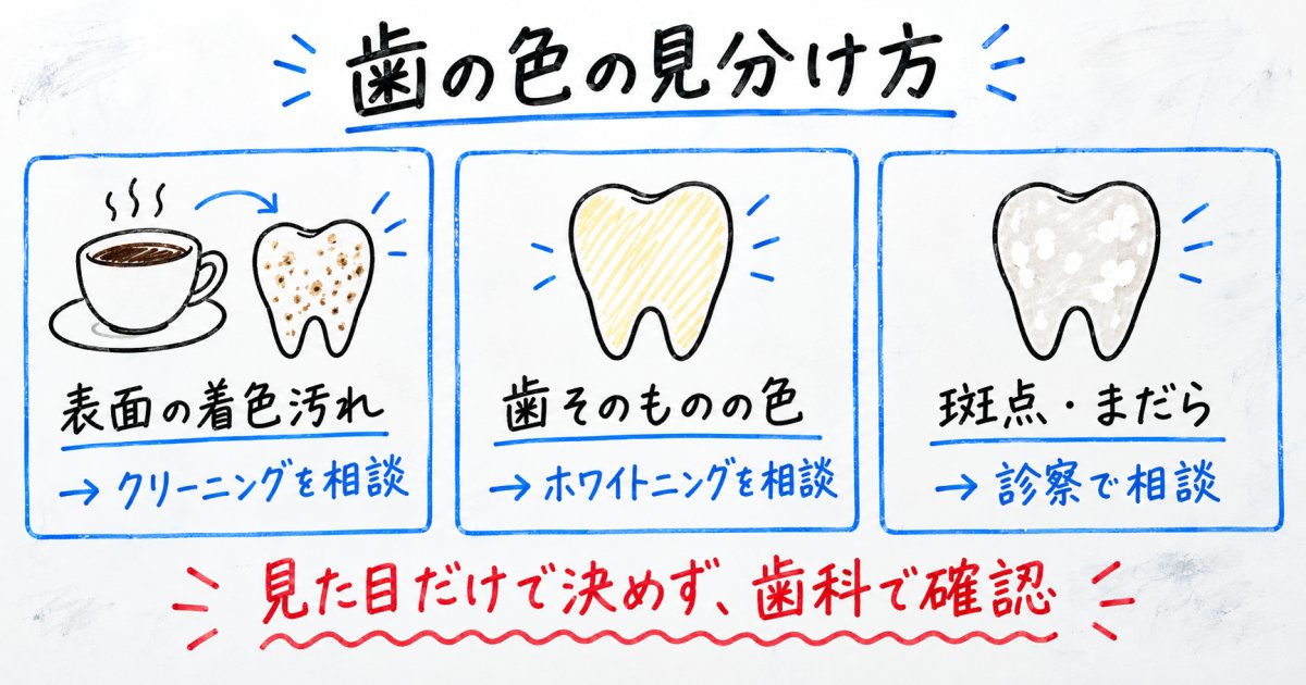 転職面接の第一印象が気になるとき、歯の色をどう見分ける？