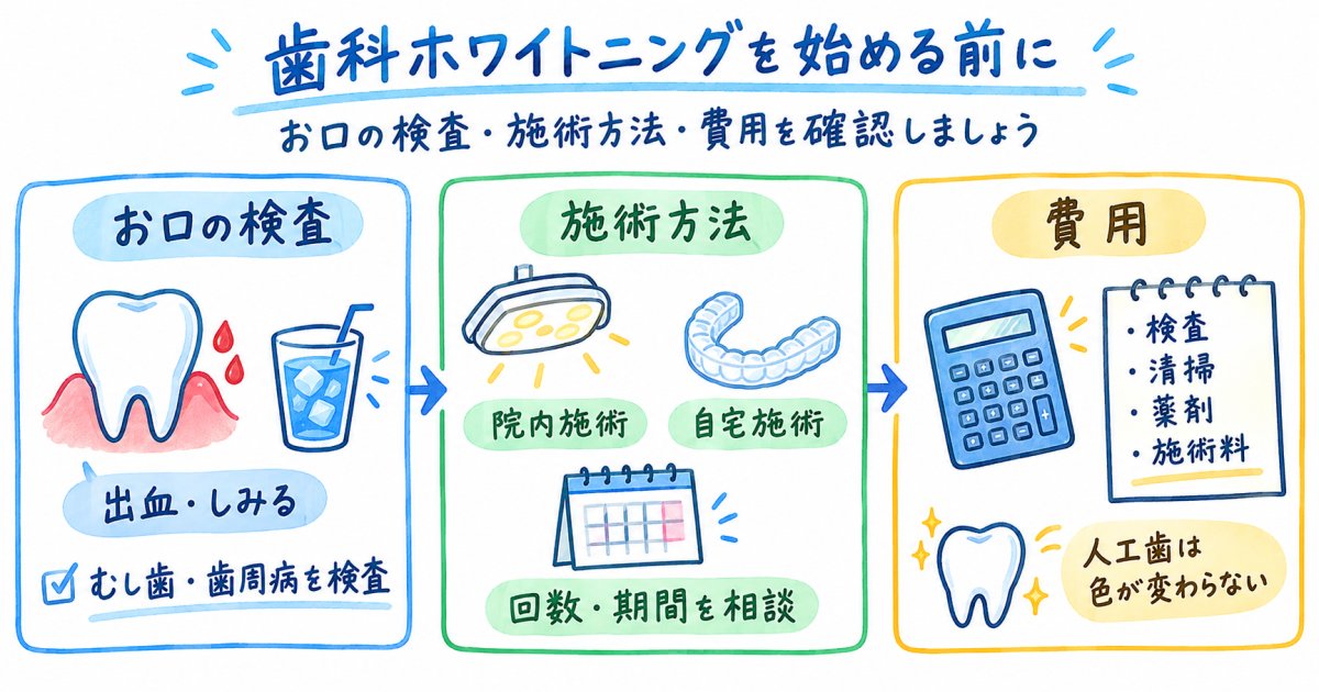 宮崎県児湯郡で歯科ホワイトニングを始める前に確認する費用と通院回数